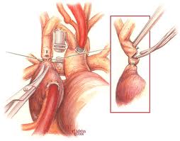 Unique Surgical Stapler